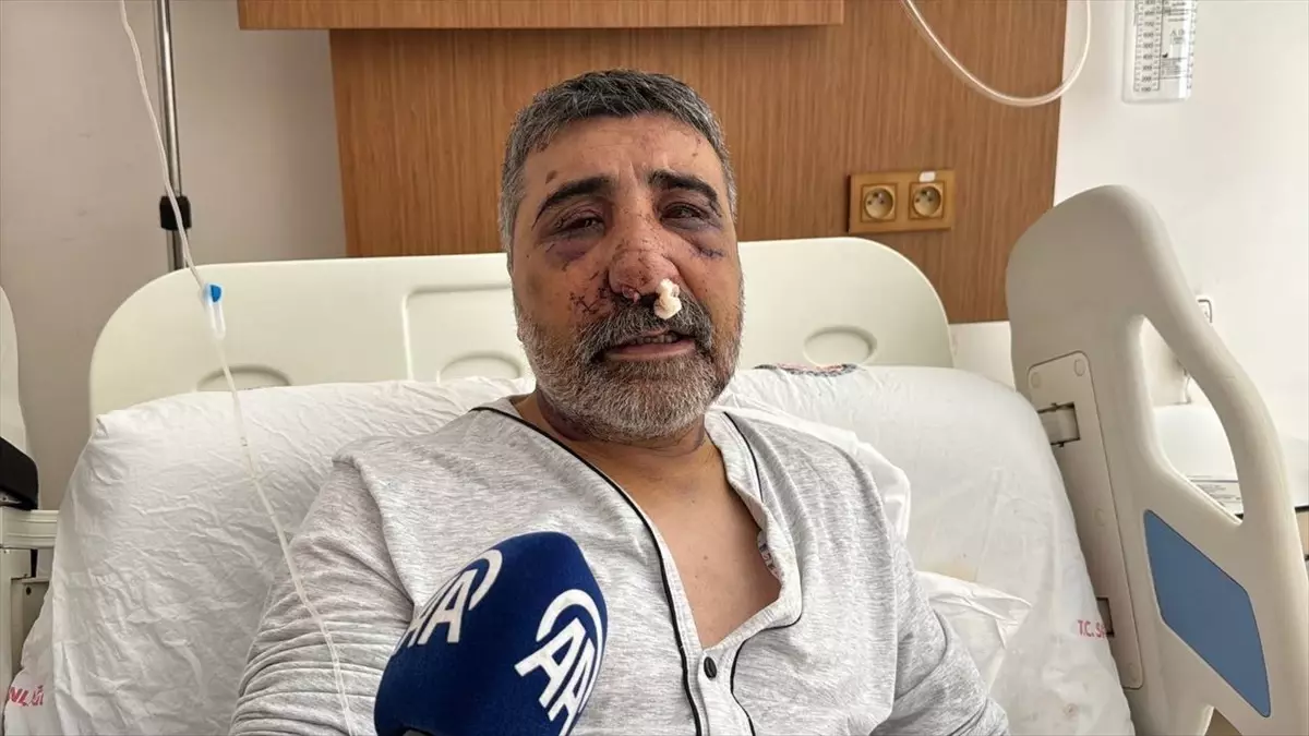 İngiliz Boksör Taksi Sürücüsünü Darbetti