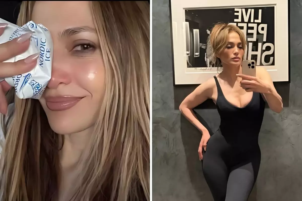 Jennifer Lopez, Amerikan Müzik Mükafatları provaları sırasında yüzünden yaralandı